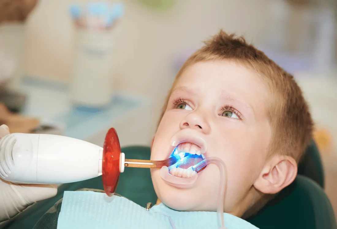 حشو أسنان أطفال